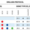 One-Piece Immediate MC Implant