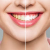 DSI WhitePro Whitening Strips