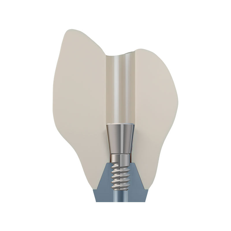 DSI EvoConnect M1.4 - Direct Сonnection Screws for Multi-Unit Abutments