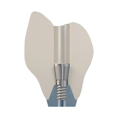 DSI EvoConnect M1.4 - Direct Сonnection Screws for Multi-Unit Abutments